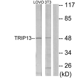 Western Blot - Anti-TRIP13 Antibody (C11092) - Antibodies.com