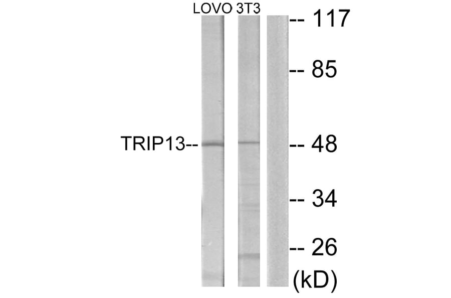 Western Blot - Anti-TRIP13 Antibody (C11092) - Antibodies.com