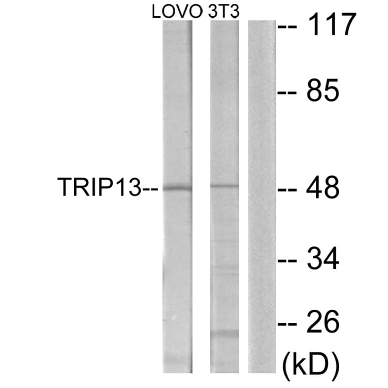 Western Blot - Anti-TRIP13 Antibody (C11092) - Antibodies.com