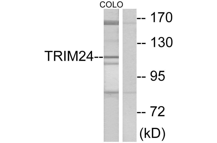 Western Blot - Anti-TRIM24 Antibody (C10073) - Antibodies.com