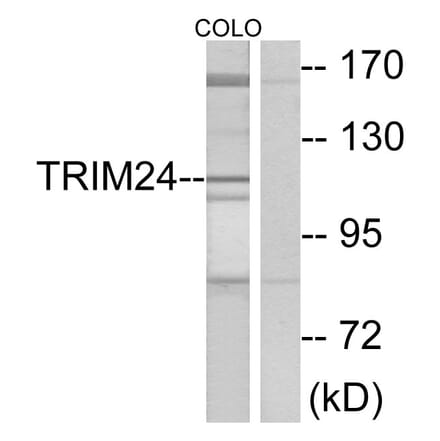 Western Blot - Anti-TRIM24 Antibody (C10073) - Antibodies.com