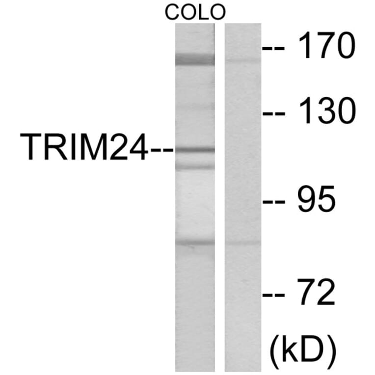 Western Blot - Anti-TRIM24 Antibody (C10073) - Antibodies.com