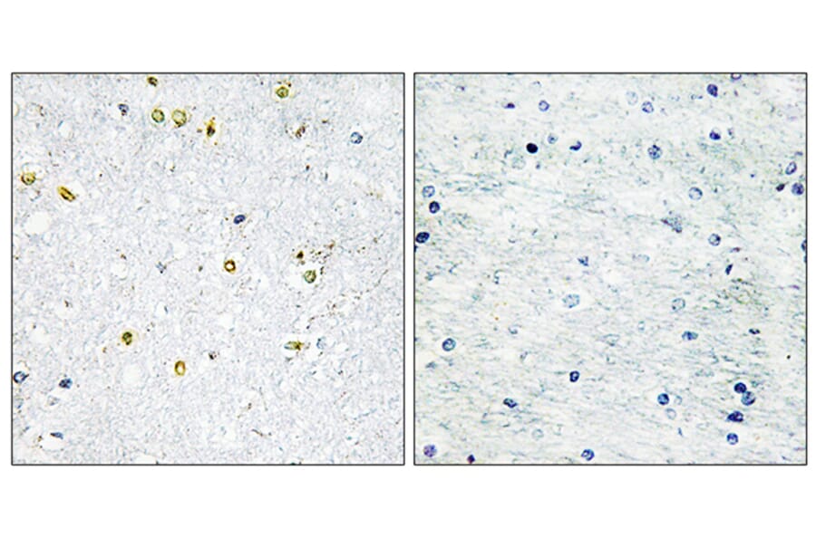 Immunohistochemistry - Anti-TRIM24 Antibody (C10073) - Antibodies.com