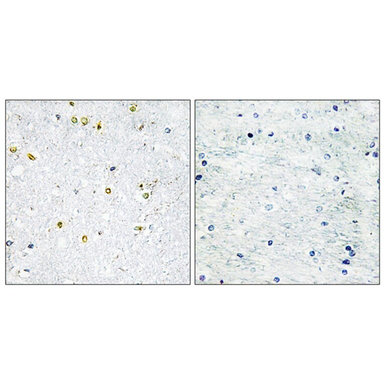 Immunohistochemistry - Anti-TRIM24 Antibody (C10073) - Antibodies.com