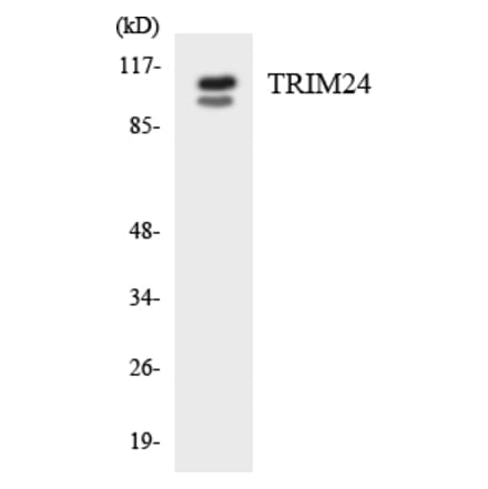 Western Blot - Anti-TRIM24 Antibody (R12-3650) - Antibodies.com