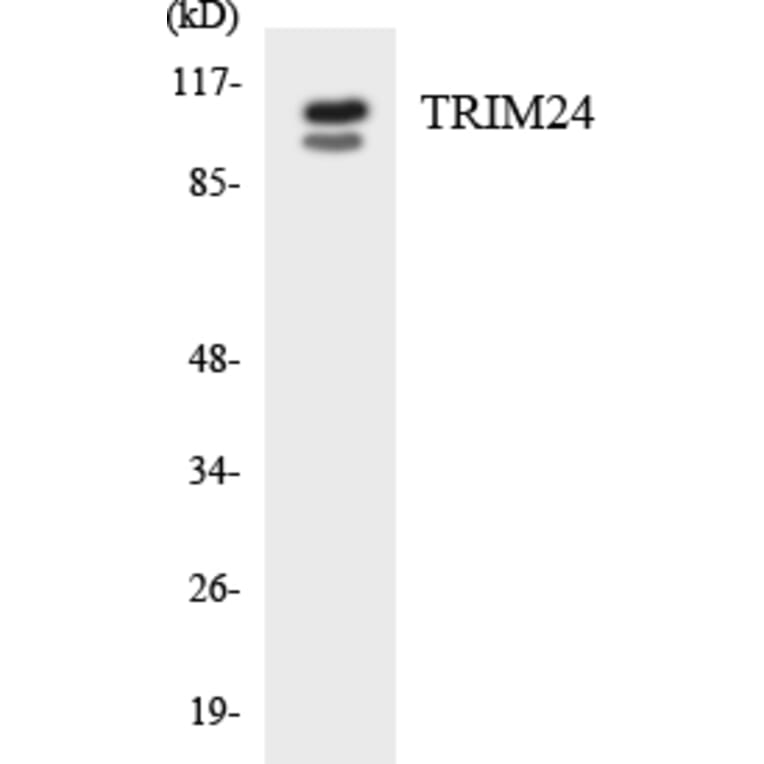 Western Blot - Anti-TRIM24 Antibody (R12-3650) - Antibodies.com