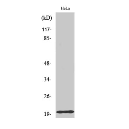 Western Blot - Anti-TOMM20 Antibody (C16678) - Antibodies.com