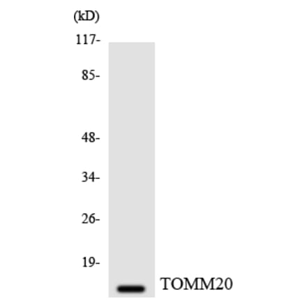 Western Blot - Anti-TOMM20 Antibody (R12-3641) - Antibodies.com