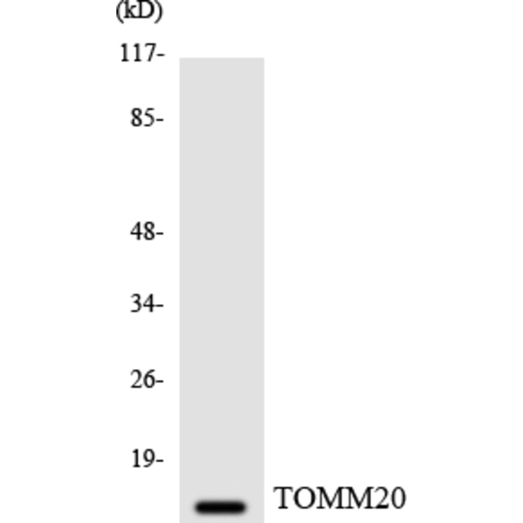 Western Blot - Anti-TOMM20 Antibody (R12-3641) - Antibodies.com