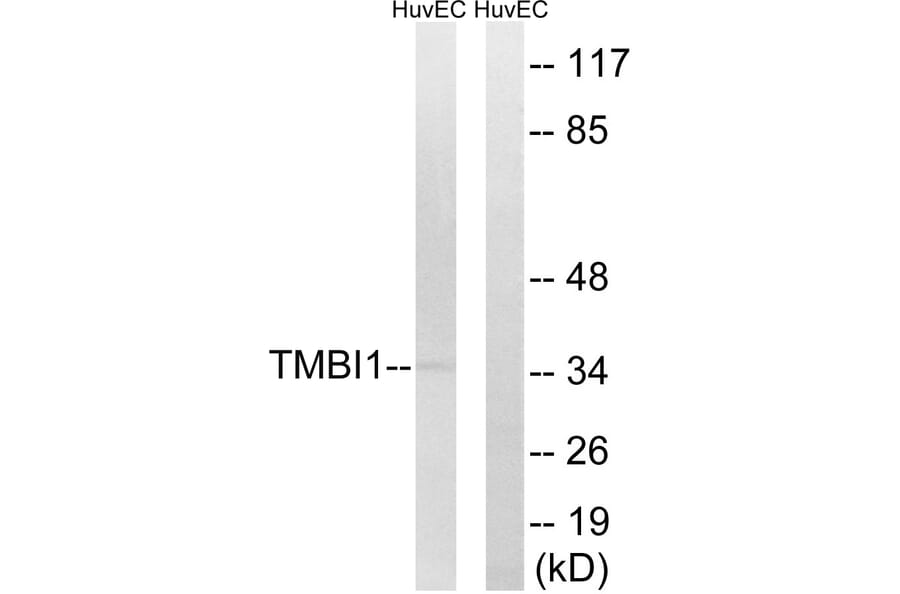 Western Blot - Anti-TMBIM1 Antibody (C19281) - Antibodies.com