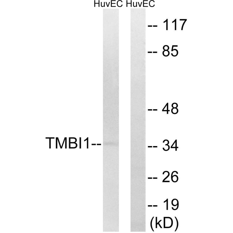 Western Blot - Anti-TMBIM1 Antibody (C19281) - Antibodies.com