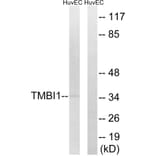 Western Blot - Anti-TMBIM1 Antibody (C19281) - Antibodies.com