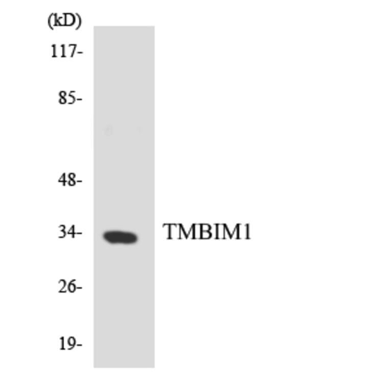 Western Blot - Anti-TMBIM1 Antibody (R12-3629) - Antibodies.com