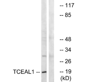 Western Blot - Anti-TCEAL1 Antibody (C19159) - Antibodies.com