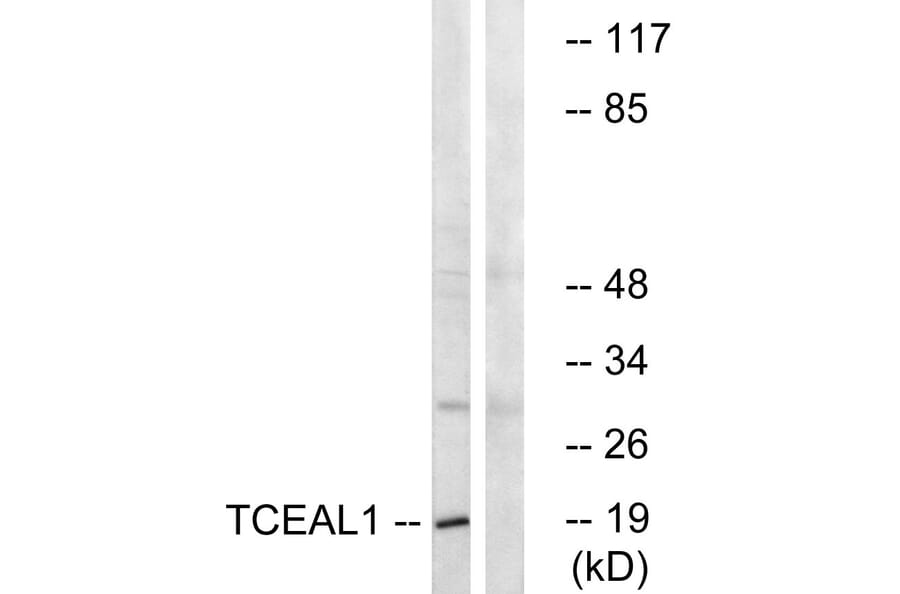 Western Blot - Anti-TCEAL1 Antibody (C19159) - Antibodies.com