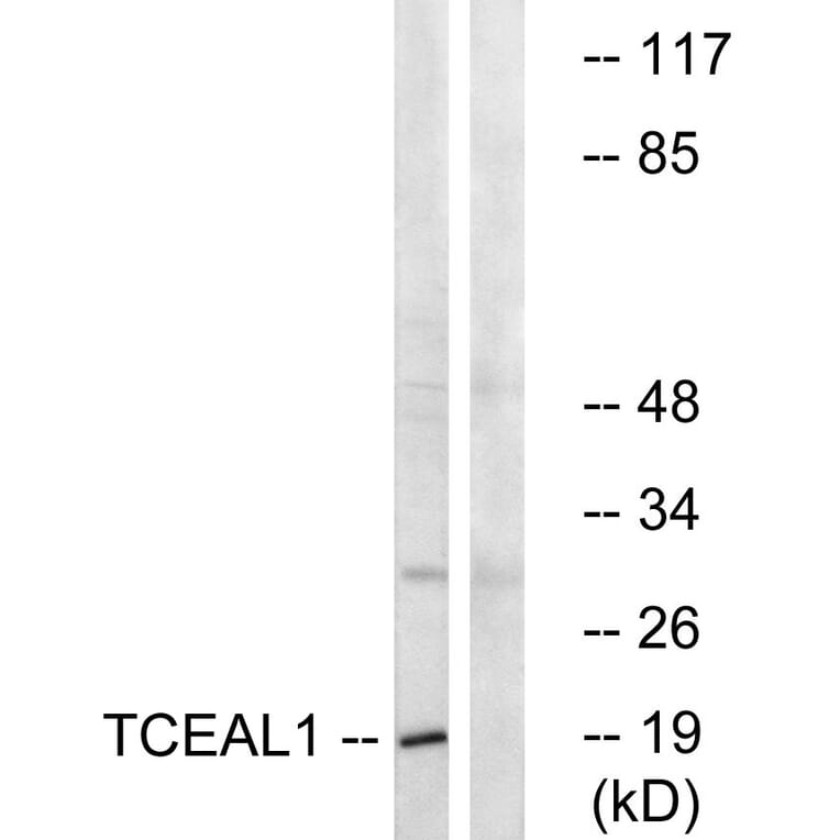 Western Blot - Anti-TCEAL1 Antibody (C19159) - Antibodies.com