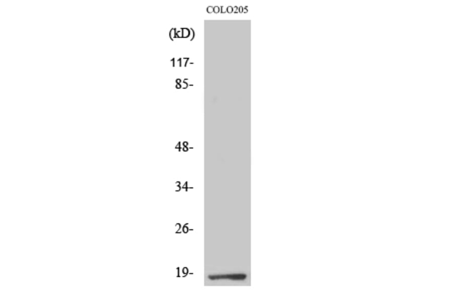 Western Blot - Anti-TCEAL1 Antibody (C19159) - Antibodies.com