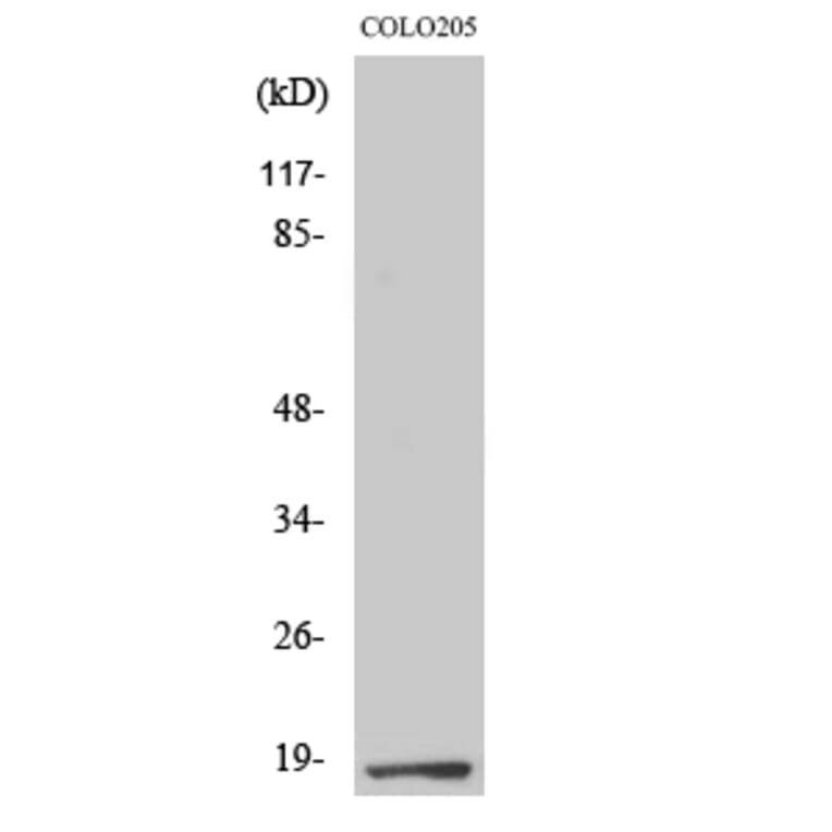 Western Blot - Anti-TCEAL1 Antibody (C19159) - Antibodies.com