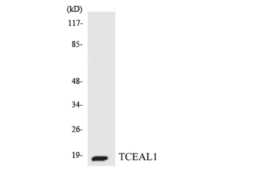 Western Blot - Anti-TCEAL1 Antibody (R12-3607) - Antibodies.com