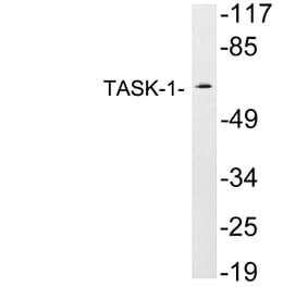 Western Blot - Anti-TASK-1 Antibody (R12-2375) - Antibodies.com