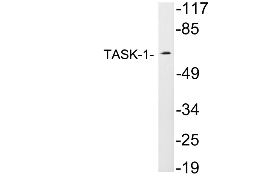 Western Blot - Anti-TASK-1 Antibody (R12-2375) - Antibodies.com