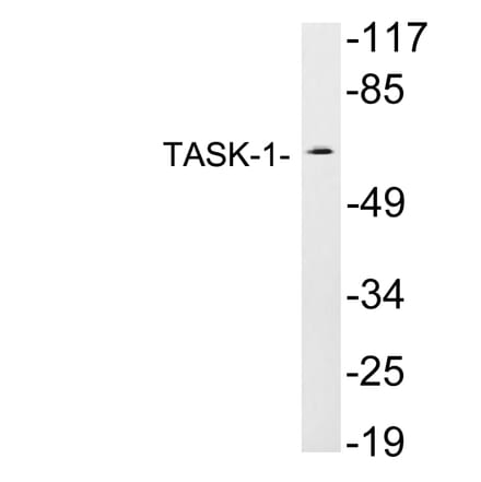 Western Blot - Anti-TASK-1 Antibody (R12-2375) - Antibodies.com