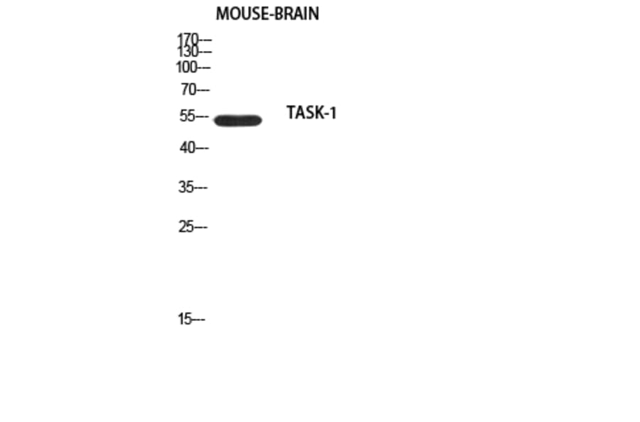 Western Blot - Anti-TASK-1 Antibody (R12-2375) - Antibodies.com