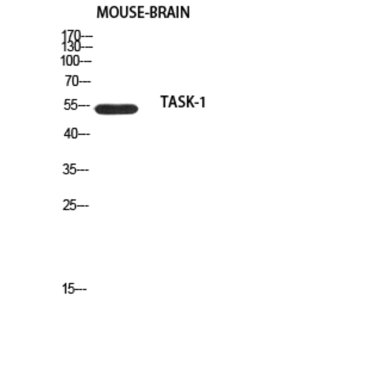Western Blot - Anti-TASK-1 Antibody (R12-2375) - Antibodies.com