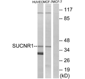 Western Blot - Anti-SUCNR1 Antibody (G748) - Antibodies.com