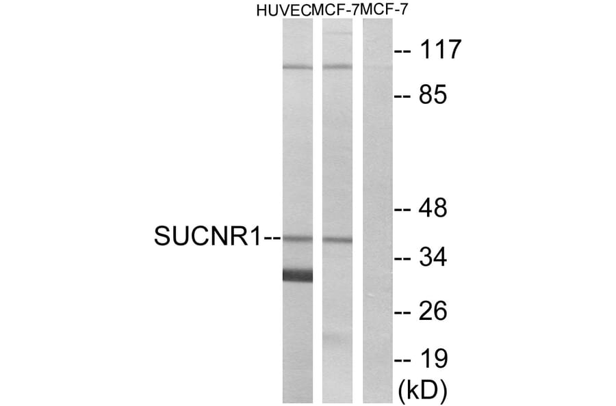 Western Blot - Anti-SUCNR1 Antibody (G748) - Antibodies.com