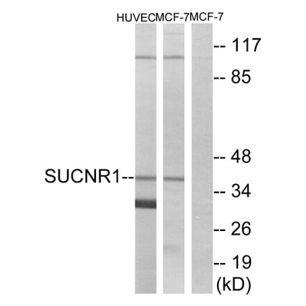 Western Blot - Anti-SUCNR1 Antibody (G748) - Antibodies.com