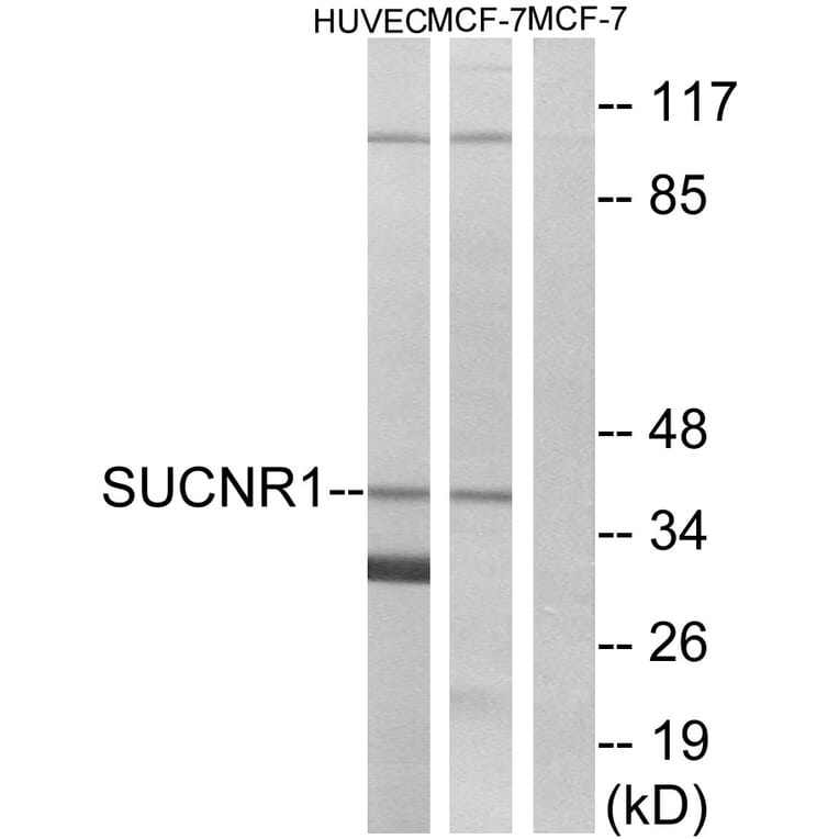 Western Blot - Anti-SUCNR1 Antibody (G748) - Antibodies.com