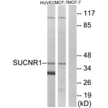 Western Blot - Anti-SUCNR1 Antibody (G748) - Antibodies.com