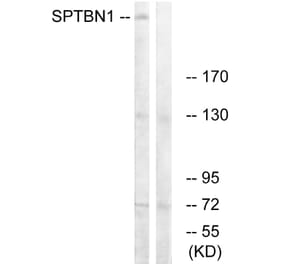 Western Blot - Anti-SPTBN1 Antibody (C18903) - Antibodies.com
