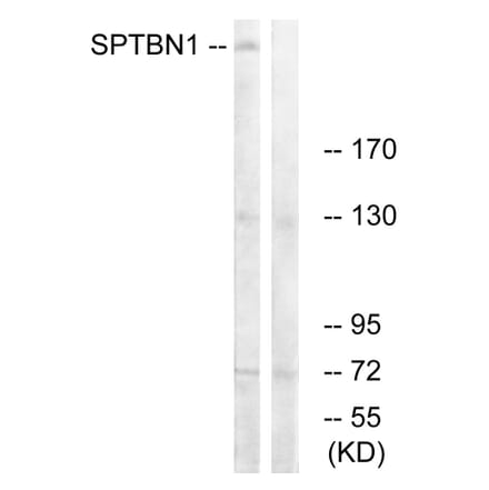 Western Blot - Anti-SPTBN1 Antibody (C18903) - Antibodies.com