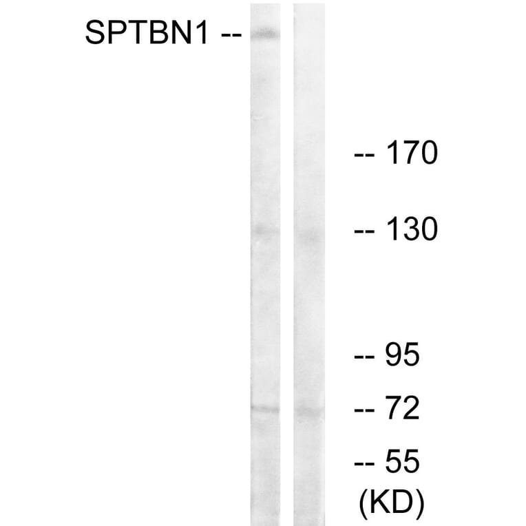 Western Blot - Anti-SPTBN1 Antibody (C18903) - Antibodies.com