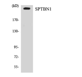 Western Blot - Anti-SPTBN1 Antibody (R12-3558) - Antibodies.com