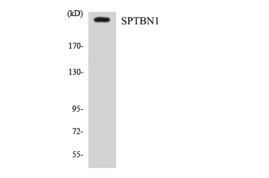 Western Blot - Anti-SPTBN1 Antibody (R12-3558) - Antibodies.com