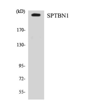 Western Blot - Anti-SPTBN1 Antibody (R12-3558) - Antibodies.com
