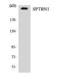 Western Blot - Anti-SPTBN1 Antibody (R12-3558) - Antibodies.com