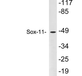 Western Blot - Anti-Sox-11 Antibody (R12-2364) - Antibodies.com