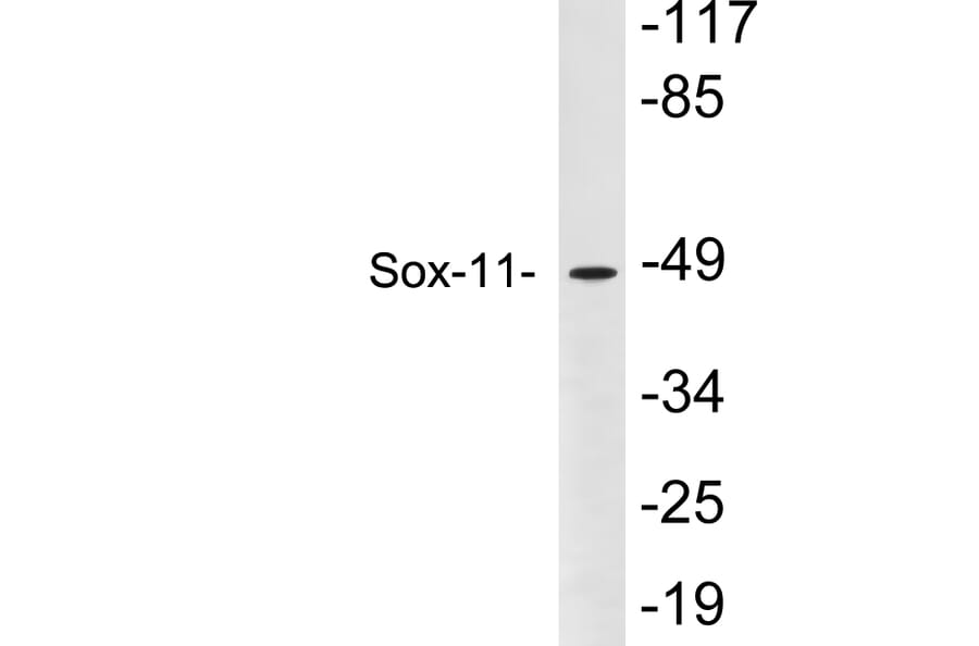 Western Blot - Anti-Sox-11 Antibody (R12-2364) - Antibodies.com
