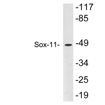 Western Blot - Anti-Sox-11 Antibody (R12-2364) - Antibodies.com