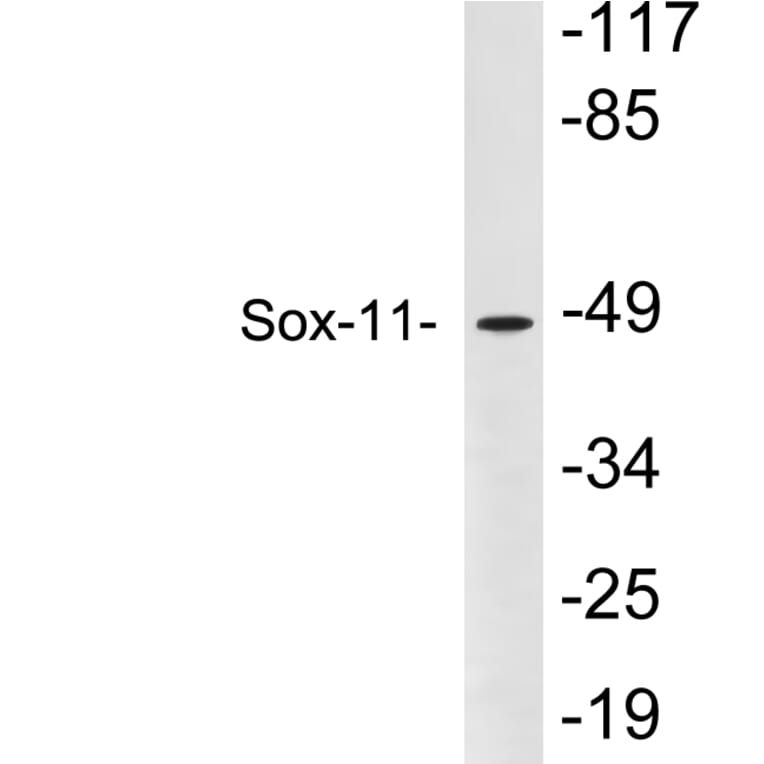Western Blot - Anti-Sox-11 Antibody (R12-2364) - Antibodies.com