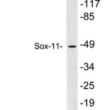 Western Blot - Anti-Sox-11 Antibody (R12-2364) - Antibodies.com