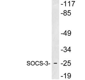 Western Blot - Anti-SOCS-3 Antibody (R12-2362) - Antibodies.com