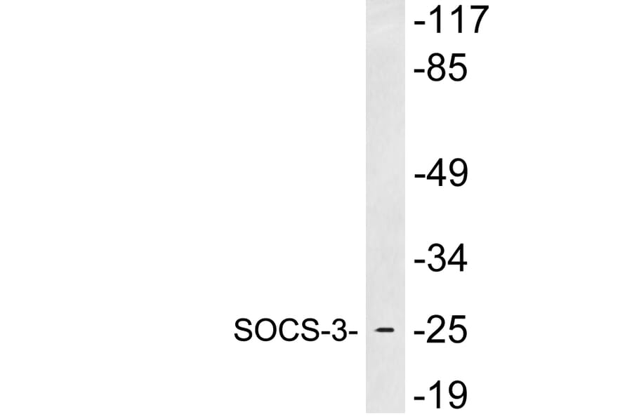 Western Blot - Anti-SOCS-3 Antibody (R12-2362) - Antibodies.com