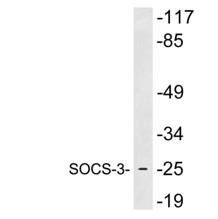 Western Blot - Anti-SOCS-3 Antibody (R12-2362) - Antibodies.com