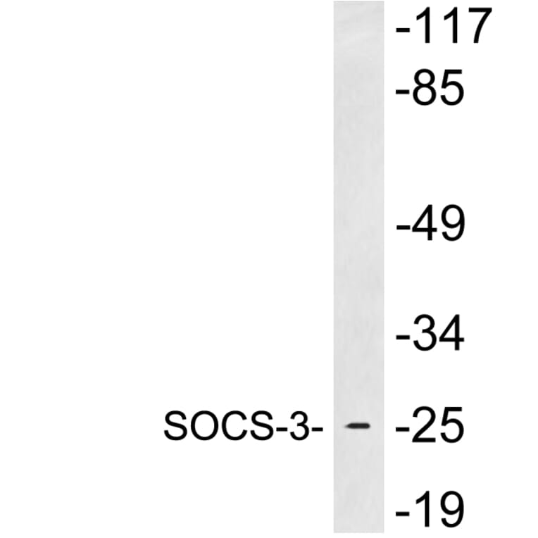 Western Blot - Anti-SOCS-3 Antibody (R12-2362) - Antibodies.com