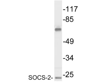 Western Blot - Anti-SOCS-2 Antibody (R12-2361) - Antibodies.com